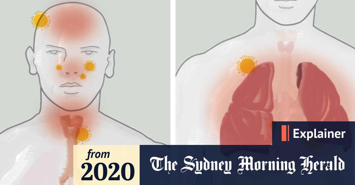 Coronavirus What does COVID19 do to humans and what is it like to have the illness?